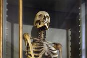 museo di anatomia umana bologna 8-2022 4734
